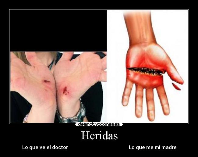 Heridas - Lo que ve el doctor Lo que me mi madre