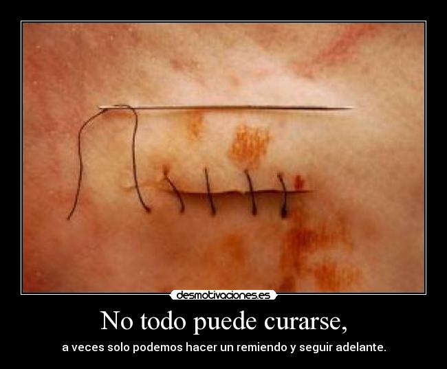 No todo puede curarse, - a veces solo podemos hacer un remiendo y seguir adelante.