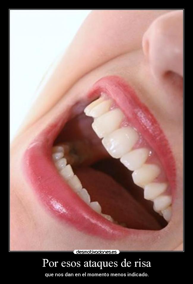 Por esos ataques de risa - que nos dan en el momento menos indicado.