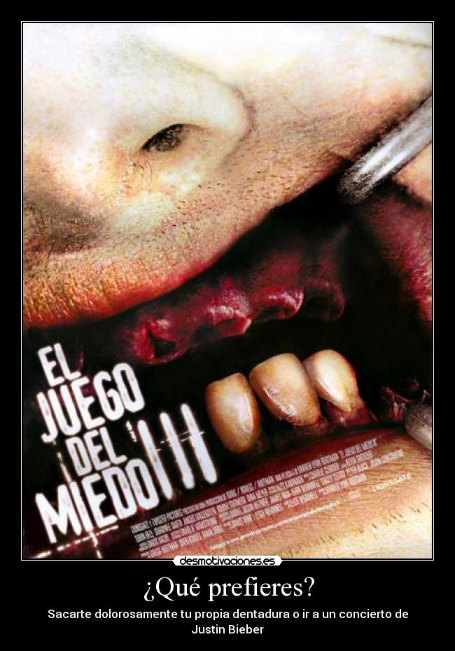 ¿Qué prefieres? - Sacarte dolorosamente tu propia dentadura o ir a un concierto de Justin Bieber