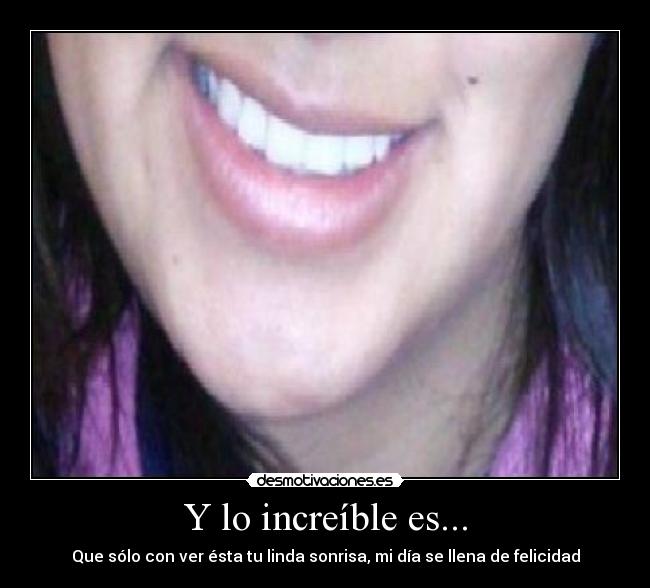 Y lo increíble es... - Que sólo con ver ésta tu linda sonrisa, mi día se llena de felicidad
