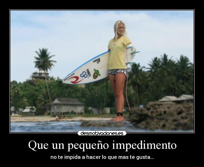 Que un pequeño impedimento -