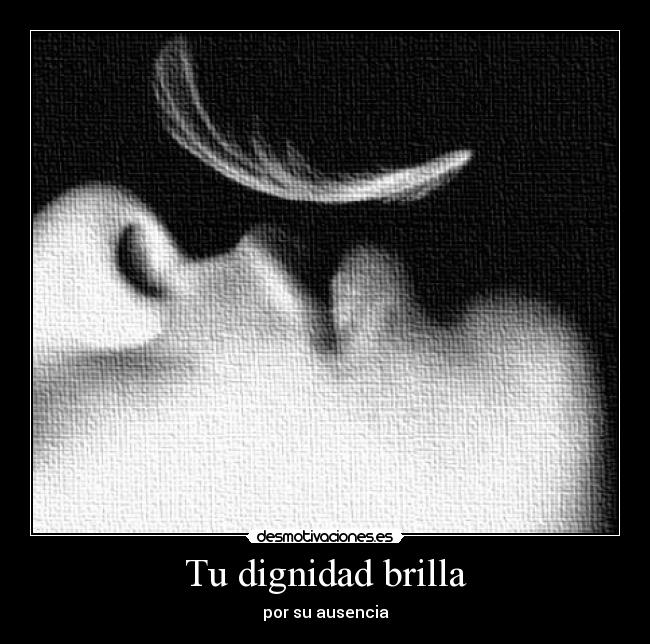 Tu dignidad brilla - por su ausencia