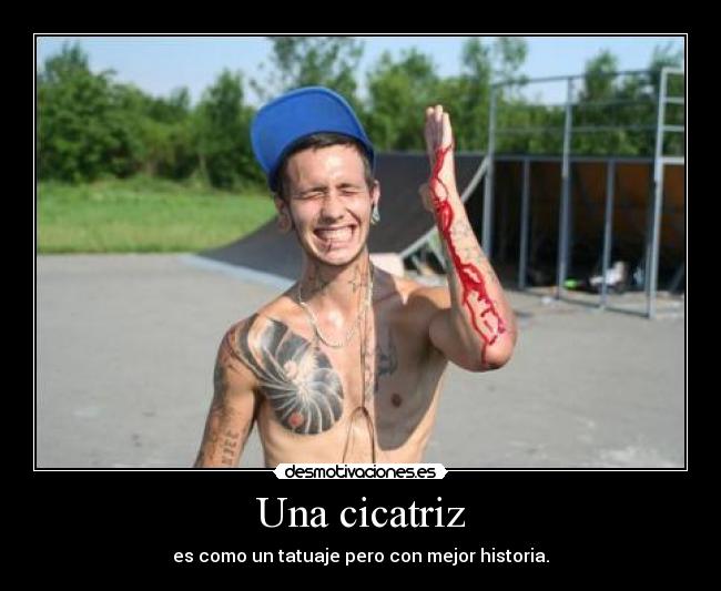 Una cicatriz - es como un tatuaje pero con mejor historia.