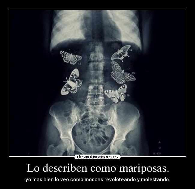 Lo describen como mariposas. - 