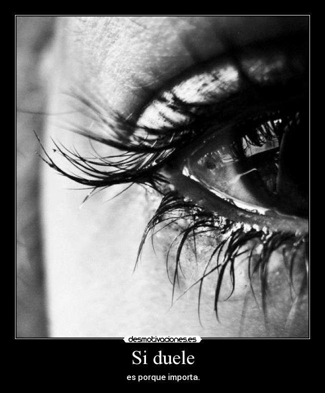 Si duele - 