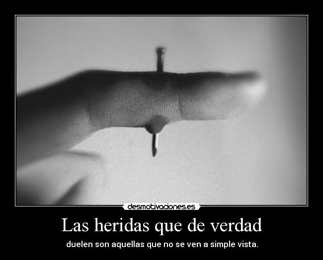 Las heridas que de verdad - 