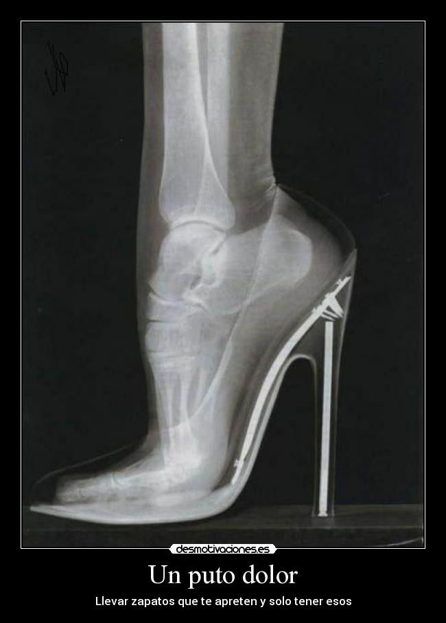 Un puto dolor - Llevar zapatos que te apreten y solo tener esos