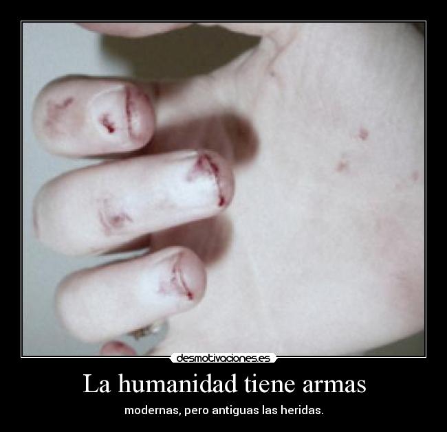 La humanidad tiene armas - modernas, pero antiguas las heridas.