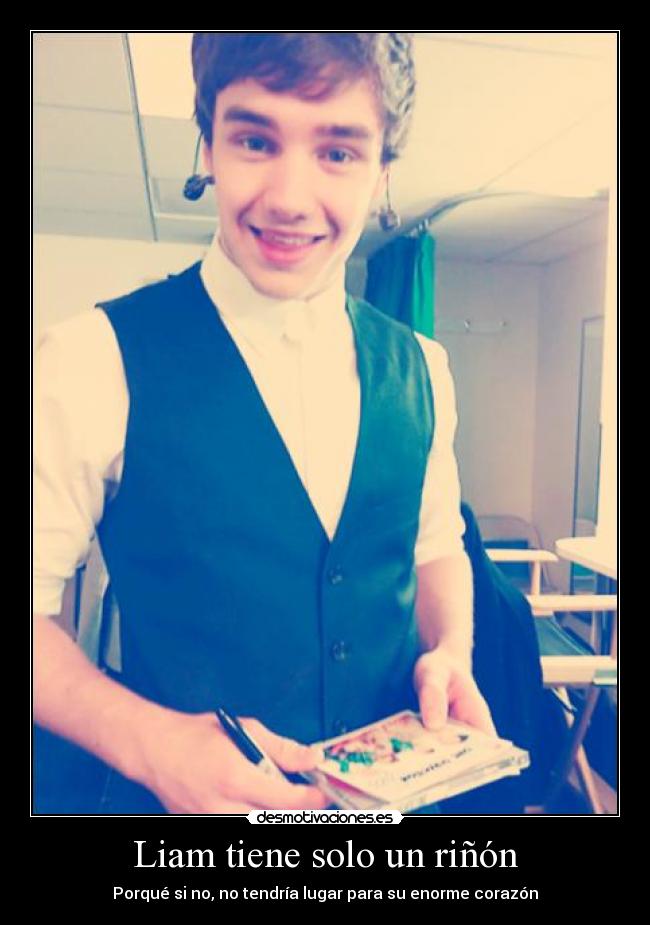 Liam tiene solo un riñón - Porqué si no, no tendría lugar para su enorme corazón♥