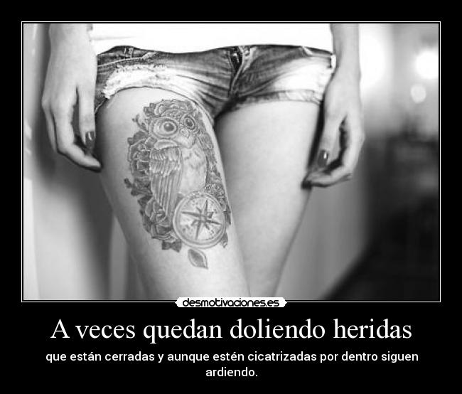 A veces quedan doliendo heridas - 