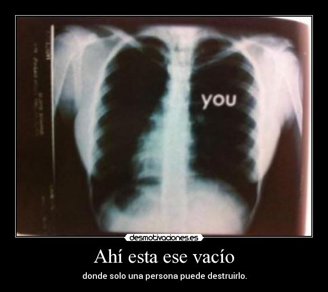 Ahí esta ese vacío -