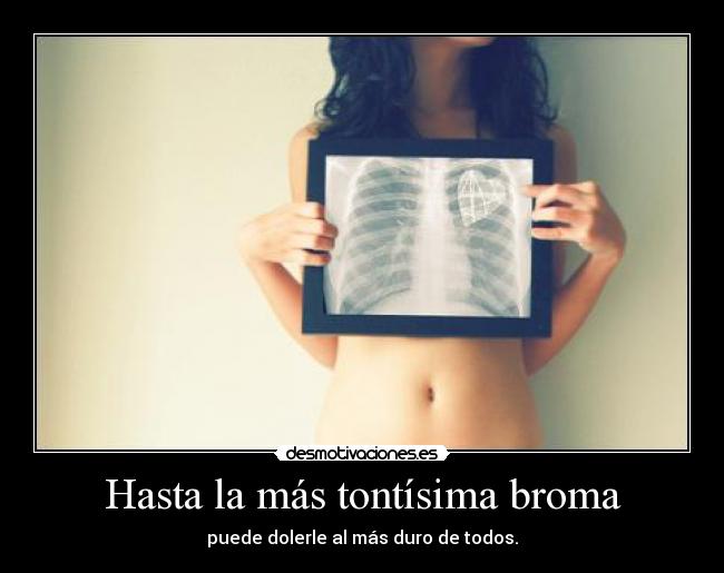 Hasta la más tontísima broma - puede dolerle al más duro de todos.