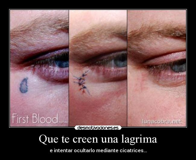 Que te creen una lagrima - e intentar ocultarlo mediante cicatrices...
