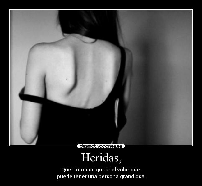 Heridas, - Que tratan de quitar el valor que 
puede tener una persona grandiosa.