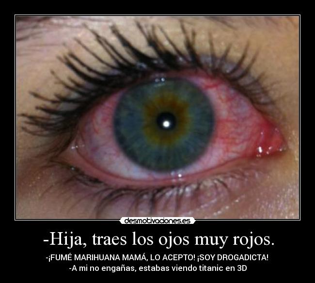 -Hija, traes los ojos muy rojos. - -¡FUMÉ MARIHUANA MAMÁ, LO ACEPTO! ¡SOY DROGADICTA! 
-A mi no engañas, estabas viendo titanic en 3D