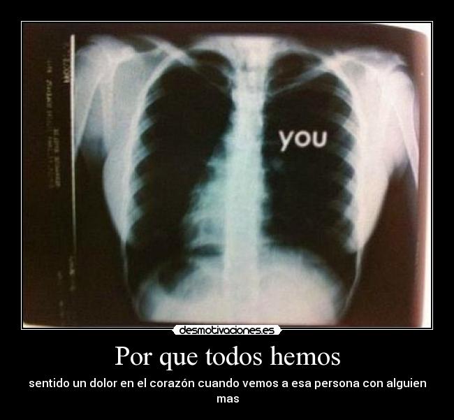 Por que todos hemos -