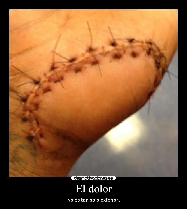 El dolor - No es tan solo exterior .