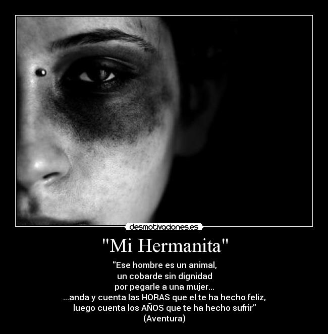 Mi Hermanita - Ese hombre es un animal,
un cobarde sin dignidad
por pegarle a una mujer...
...anda y cuenta las HORAS que el te ha hecho feliz,
luego cuenta los AÑOS que te ha hecho sufrir
(Aventura)