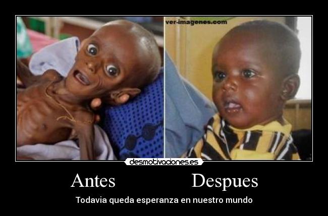 Antes Despues -