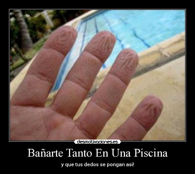 Bañarte Tanto En Una Piscina - y que tus dedos se pongan asi!