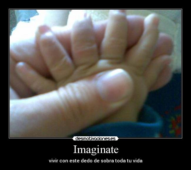 Imaginate - vivir con este dedo de sobra toda tu vida