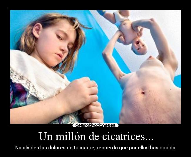 Un millón de cicatrices... - No olvides los dolores de tu madre, recuerda que por ellos has nacido.