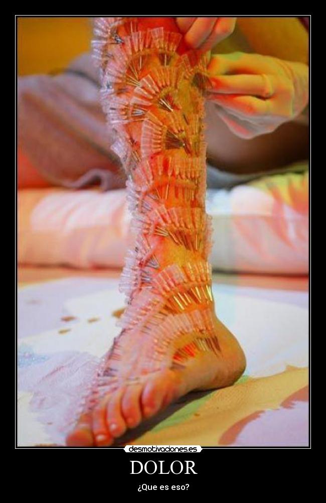 DOLOR - ¿Que es eso?
