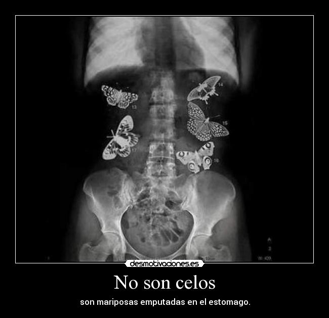 No son celos - son mariposas emputadas en el estomago.