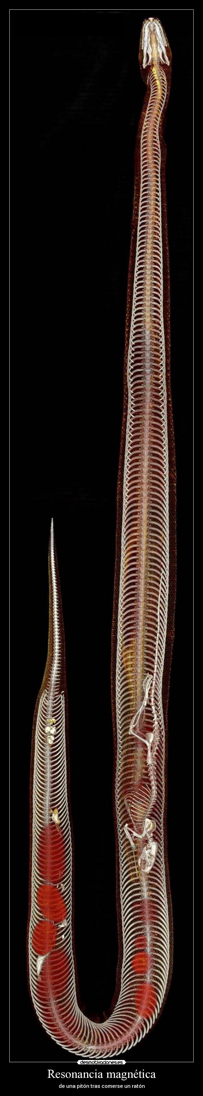 Resonancia magnética - de una pitón tras comerse un ratón