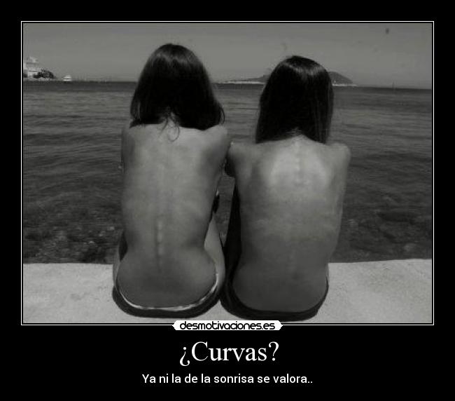 ¿Curvas? - 