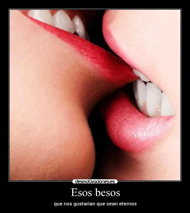 Esos besos - 