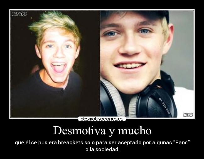 Desmotiva y mucho - que él se pusiera breackets solo para ser aceptado por algunas Fans o la sociedad.