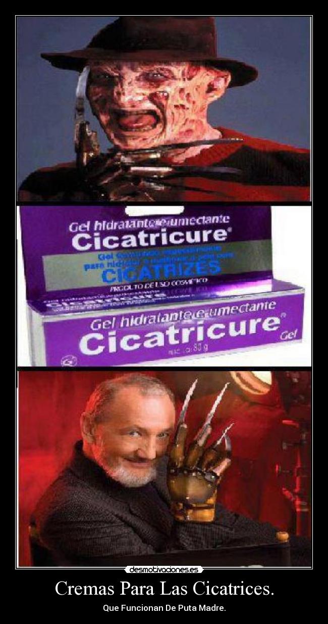 Cremas Para Las Cicatrices. - Que Funcionan De Puta Madre.