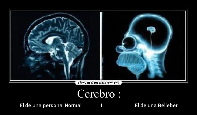 Cerebro : - El de una persona  Normal                I                           El de una Belieber