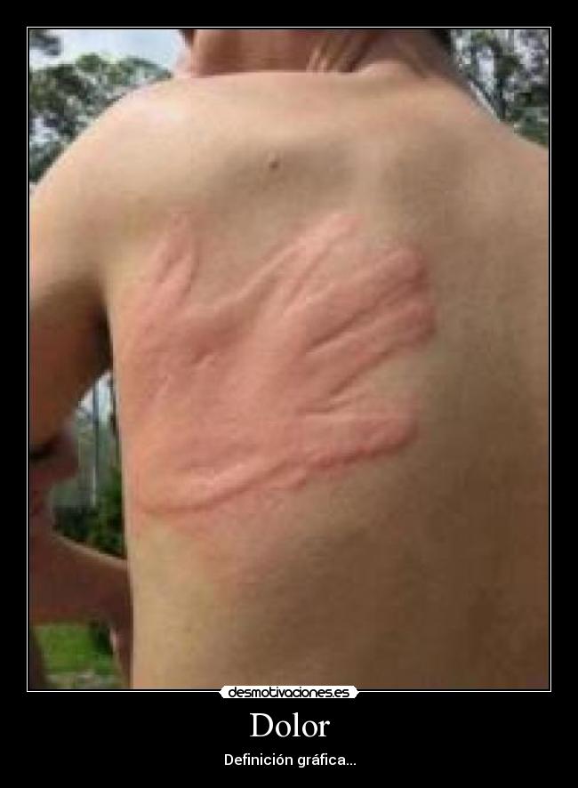 Dolor -