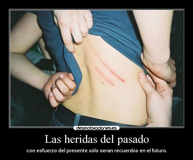 Las heridas del pasado - con esfuerzo del presente sólo seran recuerdos en el futuro.