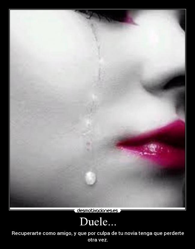 Duele... - Recuperarte como amigo, y que por culpa de tu novia tenga que perderte otra vez.