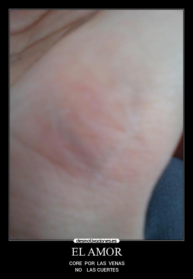 EL AMOR - CORE  POR  LAS  VENAS
NO    LAS CUERTES