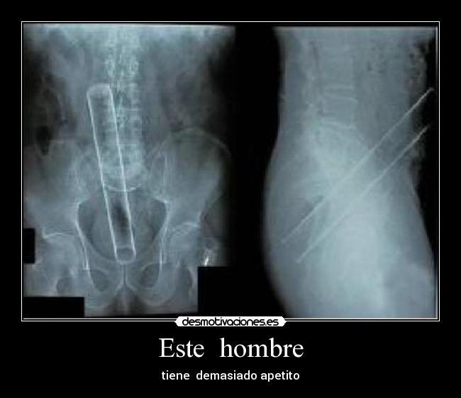 Este  hombre - 