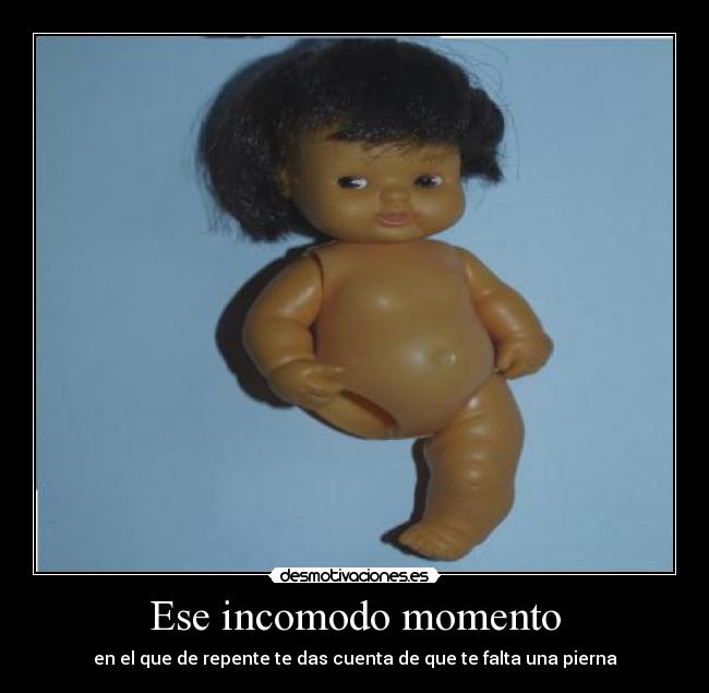 Ese incomodo momento - en el que de repente te das cuenta de que te falta una pierna