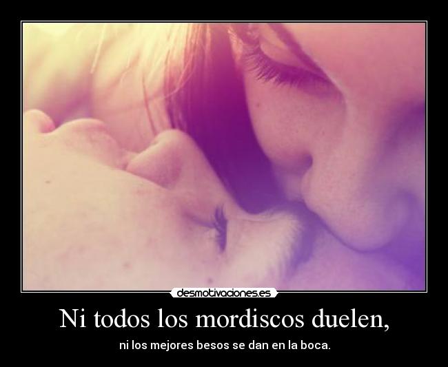 Ni todos los mordiscos duelen, - 