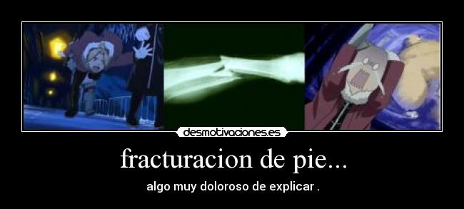 fracturacion de pie... - algo muy doloroso de explicar .