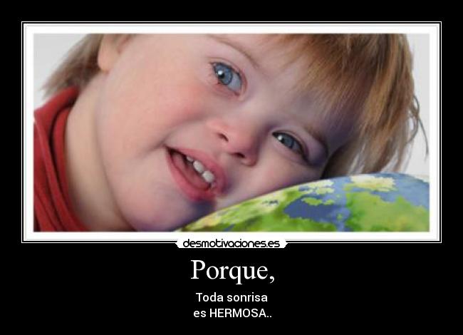 Porque, -