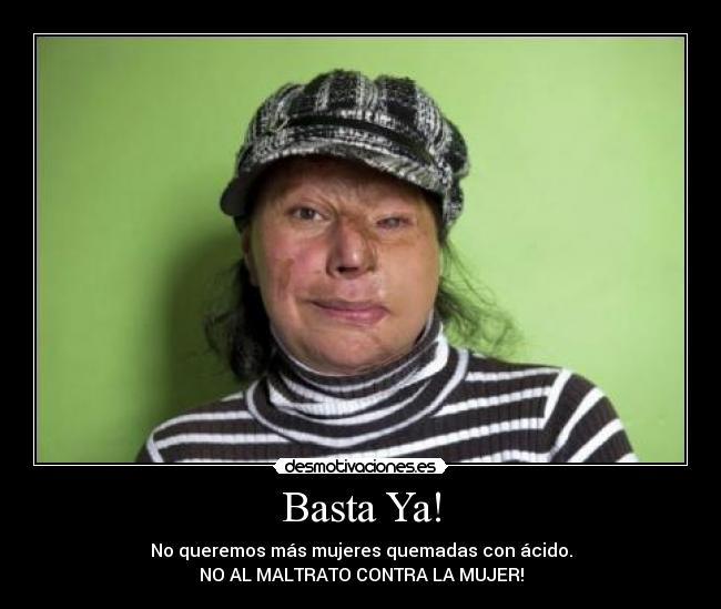 Basta Ya! - No queremos más mujeres quemadas con ácido.
NO AL MALTRATO CONTRA LA MUJER!