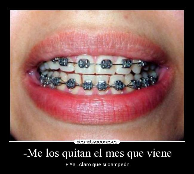 -Me los quitan el mes que viene - + Ya...claro que sí campeón