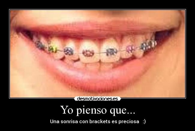 Yo pienso que... - Una sonrisa con brackets es preciosa   :)