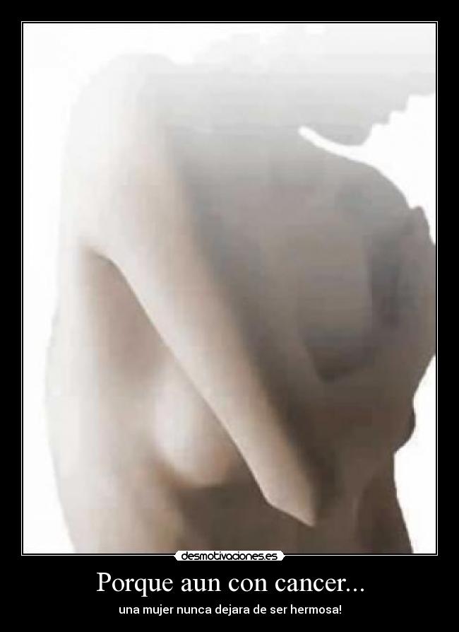 Porque aun con cancer... - una mujer nunca dejara de ser hermosa!