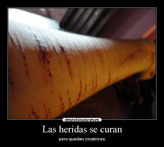 Las heridas se curan - pero quedan cicatrices.