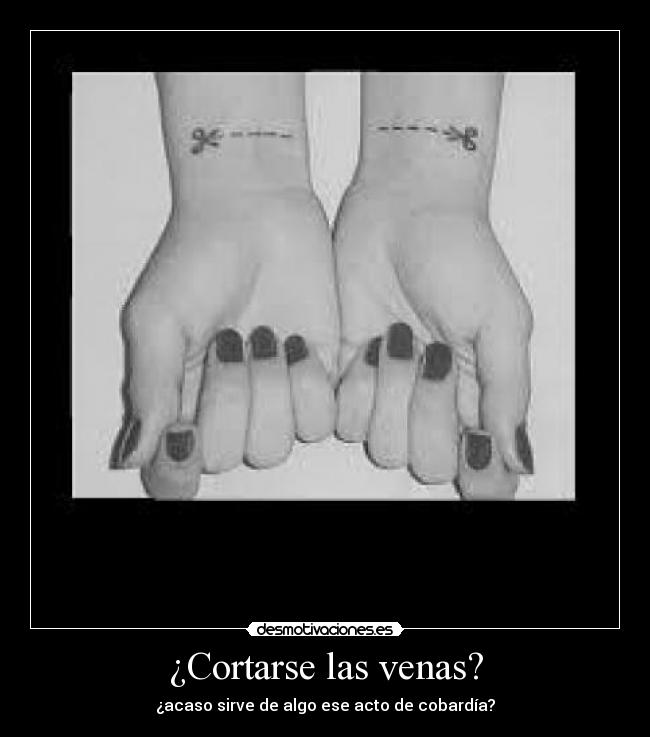 ¿Cortarse las venas? -